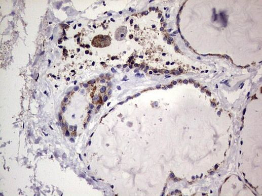 Filensin Antibody in Immunohistochemistry (Paraffin) (IHC (P))