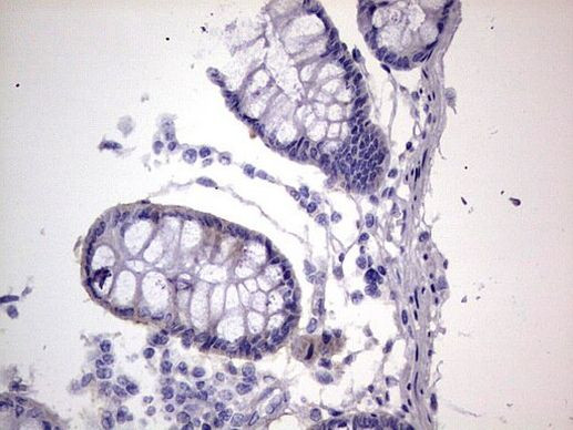 Filensin Antibody in Immunohistochemistry (Paraffin) (IHC (P))