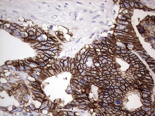 BOLL Antibody in Immunohistochemistry (Paraffin) (IHC (P))