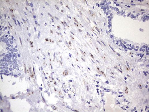 BOLL Antibody in Immunohistochemistry (Paraffin) (IHC (P))