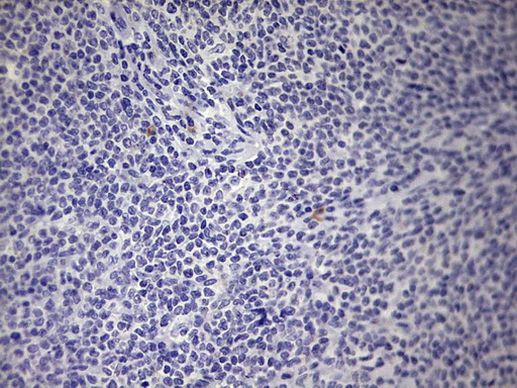 BOLL Antibody in Immunohistochemistry (Paraffin) (IHC (P))