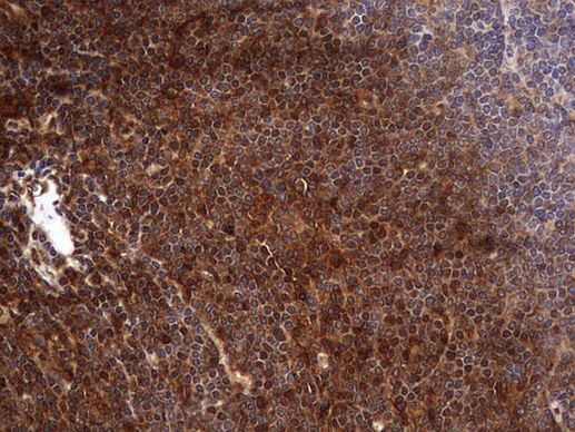 FAF1 Antibody in Immunohistochemistry (Paraffin) (IHC (P))