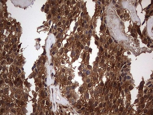 FAF1 Antibody in Immunohistochemistry (Paraffin) (IHC (P))