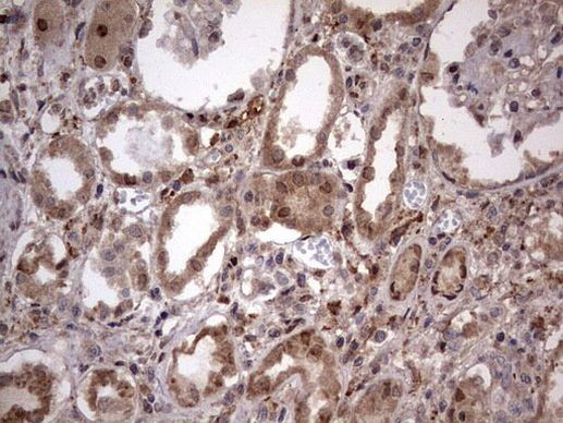 FAF1 Antibody in Immunohistochemistry (Paraffin) (IHC (P))