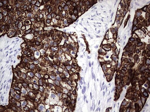 Enkurin Antibody in Immunohistochemistry (Paraffin) (IHC (P))