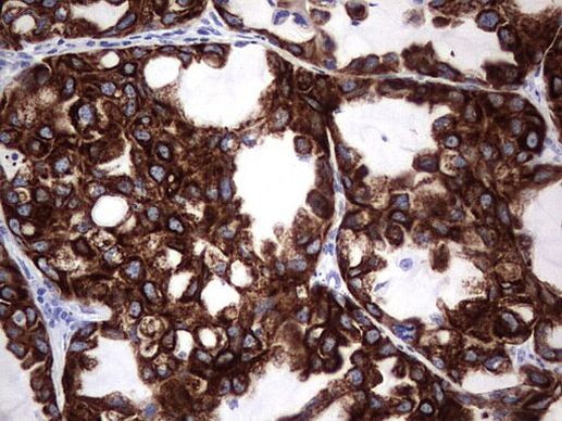 Enkurin Antibody in Immunohistochemistry (Paraffin) (IHC (P))