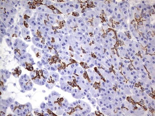 Enkurin Antibody in Immunohistochemistry (Paraffin) (IHC (P))