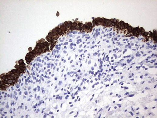 Enkurin Antibody in Immunohistochemistry (Paraffin) (IHC (P))