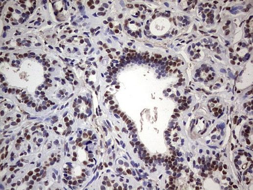 MYF5 Antibody in Immunohistochemistry (Paraffin) (IHC (P))