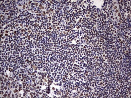 MYF5 Antibody in Immunohistochemistry (Paraffin) (IHC (P))