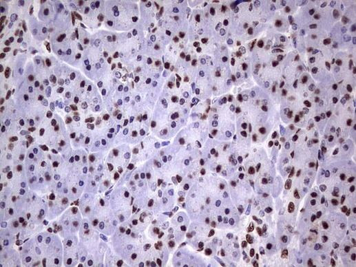 MYF5 Antibody in Immunohistochemistry (Paraffin) (IHC (P))