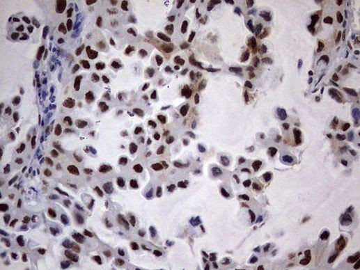 N4BP2L2 Antibody in Immunohistochemistry (Paraffin) (IHC (P))