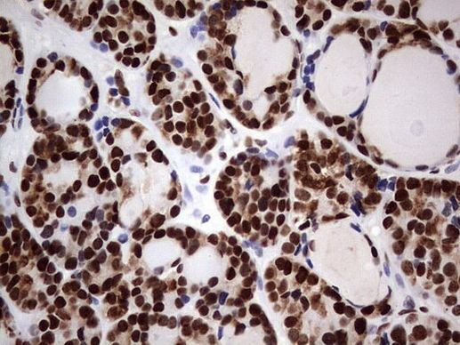 N4BP2L2 Antibody in Immunohistochemistry (Paraffin) (IHC (P))