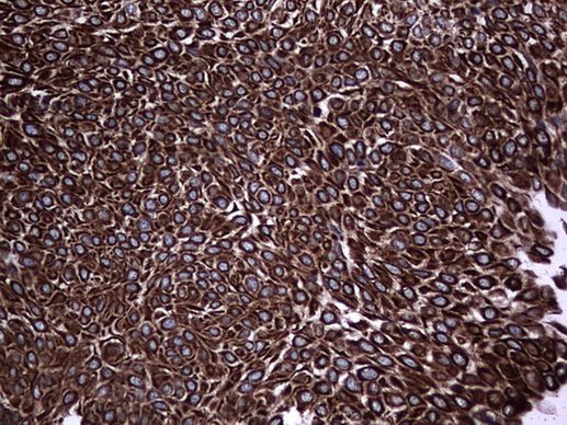 MIP-3 beta Antibody in Immunohistochemistry (Paraffin) (IHC (P))