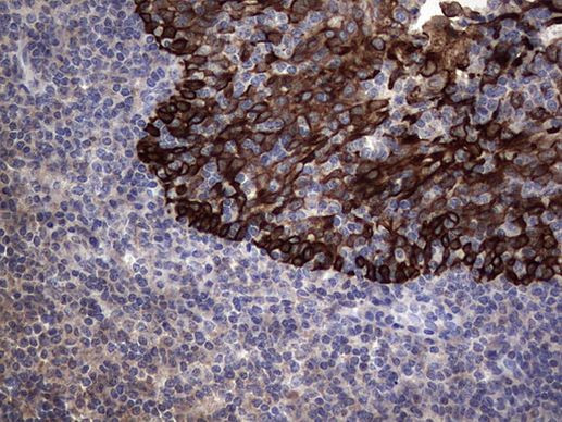 MIP-3 beta Antibody in Immunohistochemistry (Paraffin) (IHC (P))