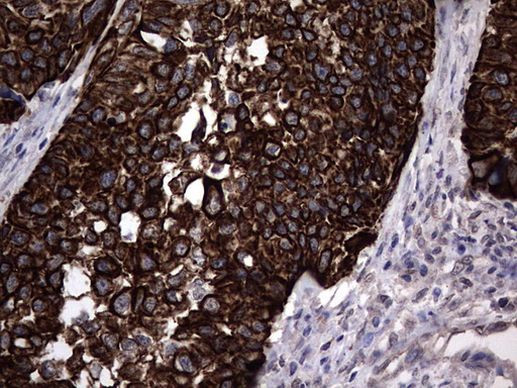 MIP-3 beta Antibody in Immunohistochemistry (Paraffin) (IHC (P))