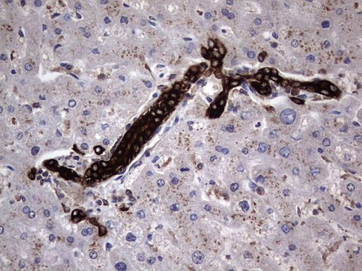 MIP-3 beta Antibody in Immunohistochemistry (Paraffin) (IHC (P))