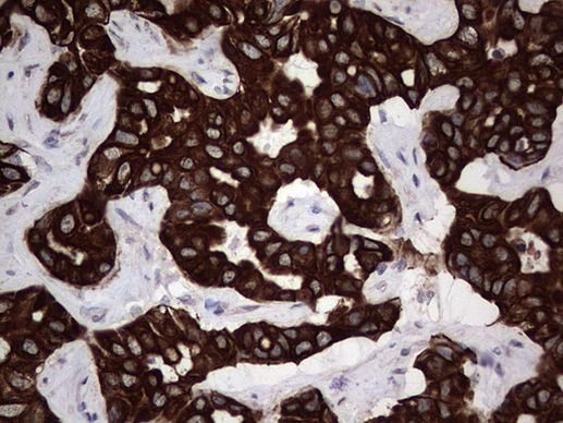 MIP-3 beta Antibody in Immunohistochemistry (Paraffin) (IHC (P))