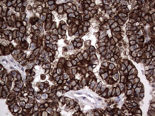 MIP-3 beta Antibody in Immunohistochemistry (Paraffin) (IHC (P))