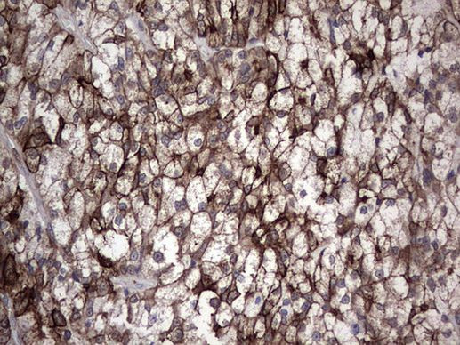 MIP-3 beta Antibody in Immunohistochemistry (Paraffin) (IHC (P))