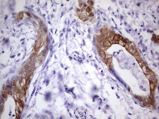 S100A6 Antibody in Immunohistochemistry (Paraffin) (IHC (P))