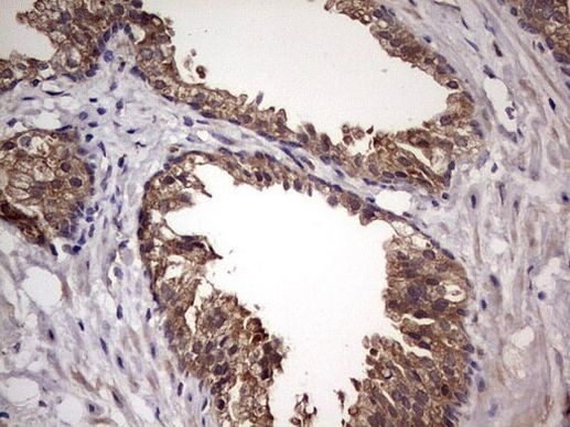 UFD1L Antibody in Immunohistochemistry (Paraffin) (IHC (P))