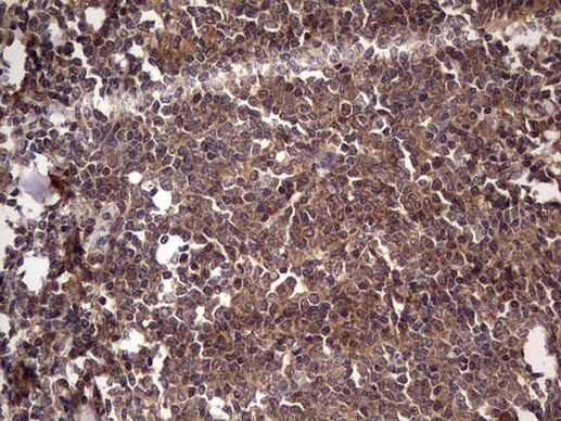 UFD1L Antibody in Immunohistochemistry (Paraffin) (IHC (P))