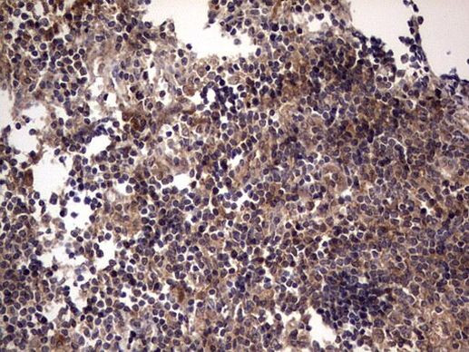 UFD1L Antibody in Immunohistochemistry (Paraffin) (IHC (P))