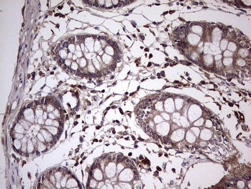 UFD1L Antibody in Immunohistochemistry (Paraffin) (IHC (P))