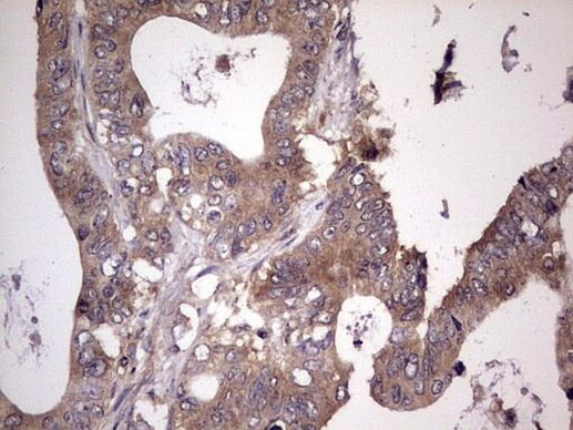 UFD1L Antibody in Immunohistochemistry (Paraffin) (IHC (P))