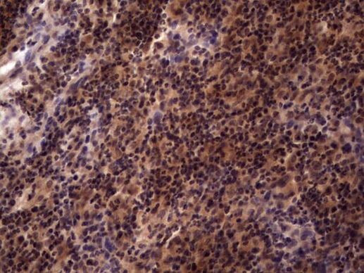 UFD1L Antibody in Immunohistochemistry (Paraffin) (IHC (P))