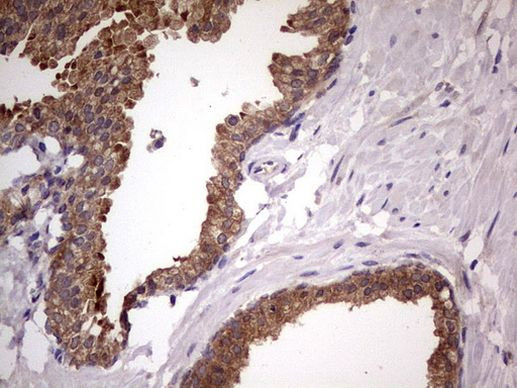 DDX6 Antibody in Immunohistochemistry (Paraffin) (IHC (P))