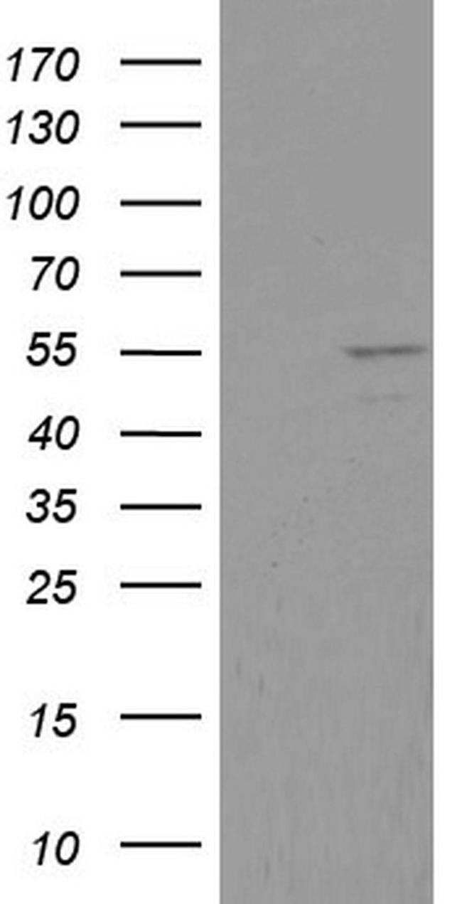 DDX6 Antibody in Western Blot (WB)