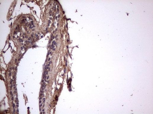 BFSP2 Antibody in Immunohistochemistry (Paraffin) (IHC (P))