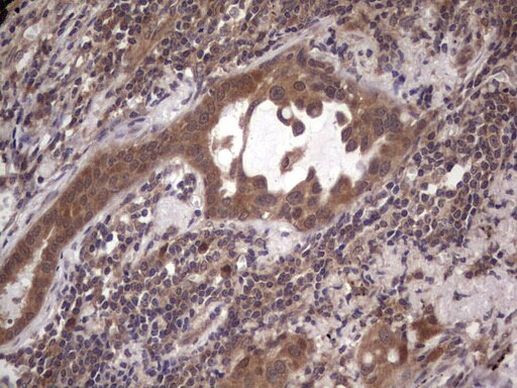 BFSP2 Antibody in Immunohistochemistry (Paraffin) (IHC (P))