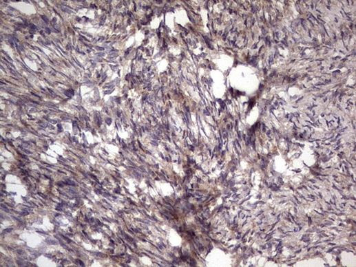 BFSP2 Antibody in Immunohistochemistry (Paraffin) (IHC (P))