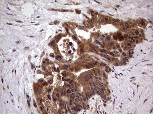 BFSP2 Antibody in Immunohistochemistry (Paraffin) (IHC (P))