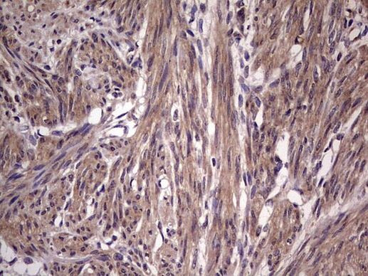 BFSP2 Antibody in Immunohistochemistry (Paraffin) (IHC (P))