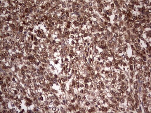 BFSP2 Antibody in Immunohistochemistry (Paraffin) (IHC (P))