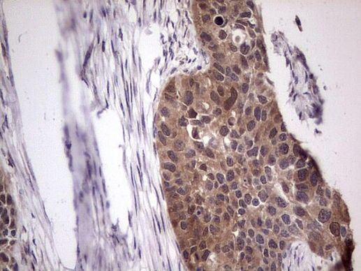 BFSP2 Antibody in Immunohistochemistry (Paraffin) (IHC (P))