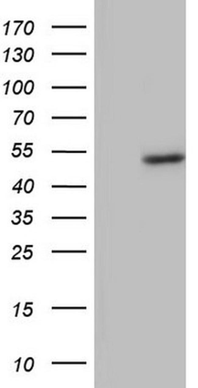 BFSP2 Antibody in Western Blot (WB)