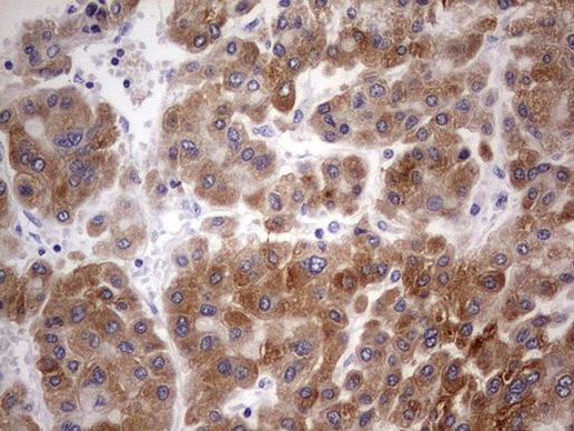 BFSP2 Antibody in Immunohistochemistry (Paraffin) (IHC (P))