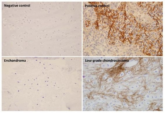 Periostin Antibody in Immunohistochemistry (Paraffin) (IHC (P))