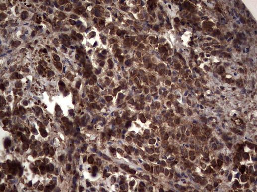 RSPO3 Antibody in Immunohistochemistry (Paraffin) (IHC (P))