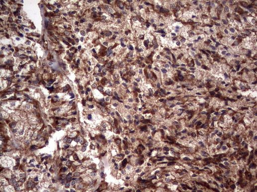 RSPO3 Antibody in Immunohistochemistry (Paraffin) (IHC (P))