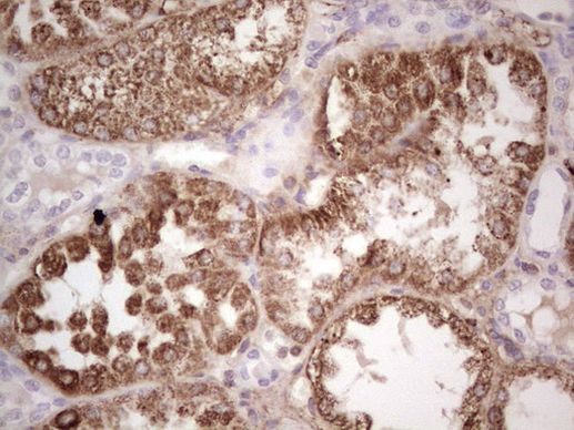 RSPO3 Antibody in Immunohistochemistry (Paraffin) (IHC (P))