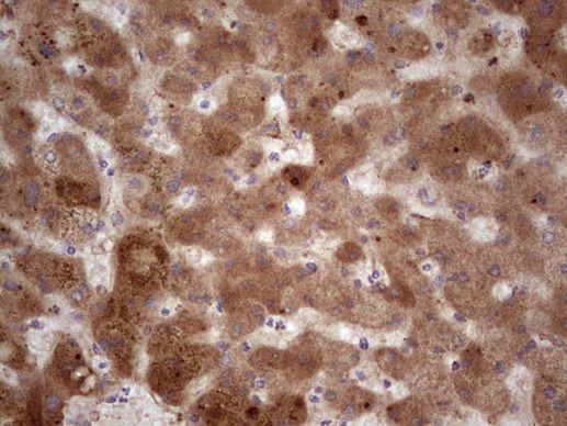 RSPO3 Antibody in Immunohistochemistry (Paraffin) (IHC (P))