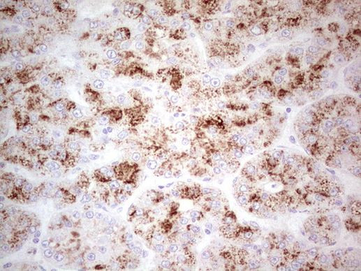 POMK Antibody in Immunohistochemistry (Paraffin) (IHC (P))