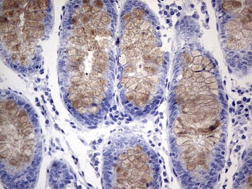 RSPO1 Antibody in Immunohistochemistry (Paraffin) (IHC (P))