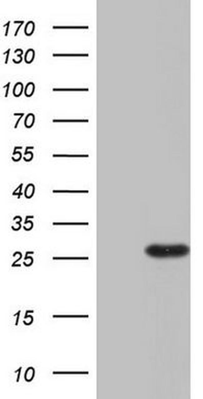 RSPO1 Antibody in Western Blot (WB)